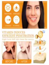 Vitamin C Brightening Serum - Dark Spot Remover & Whitening
