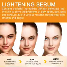 Vitamin C Brightening Serum - Dark Spot Remover & Whitening