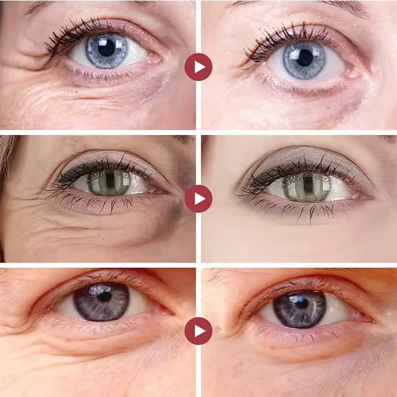 Retinol Eye Cream - Instant Dark Circle & Puffiness Remover