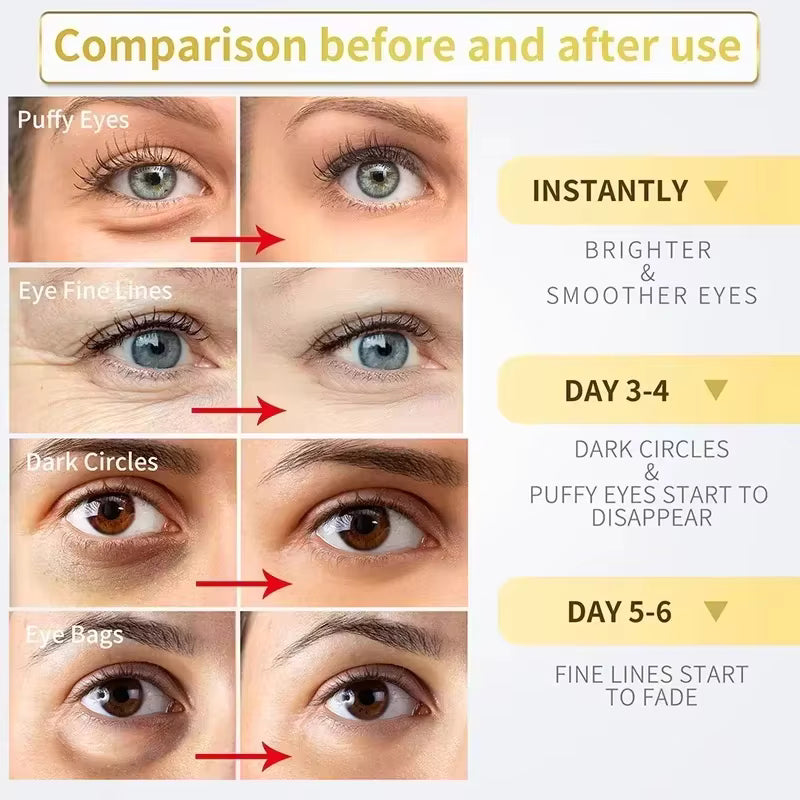 Retinol Eye Cream - Instant Dark Circle & Puffiness Remover