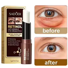 Retinol Eye Cream - Instant Dark Circle & Puffiness Remover