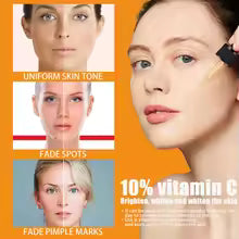 Vitamin C Brightening Serum - Dark Spot Remover & Whitening