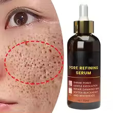 Pore Shrink Face Serum - Acne Control & Blackhead Remover