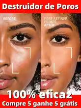 Pore Shrink Face Serum - Acne Control & Blackhead Remover